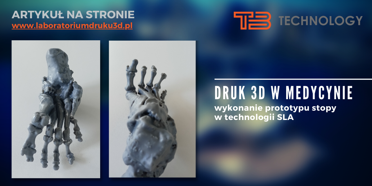 Read more about the article Druk 3D w medycynie
